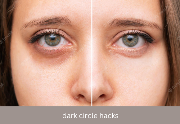 You are currently viewing 7 day challenge Dark Circle Hacks with Coffee Aloe Vera Gel And Ice Cubes